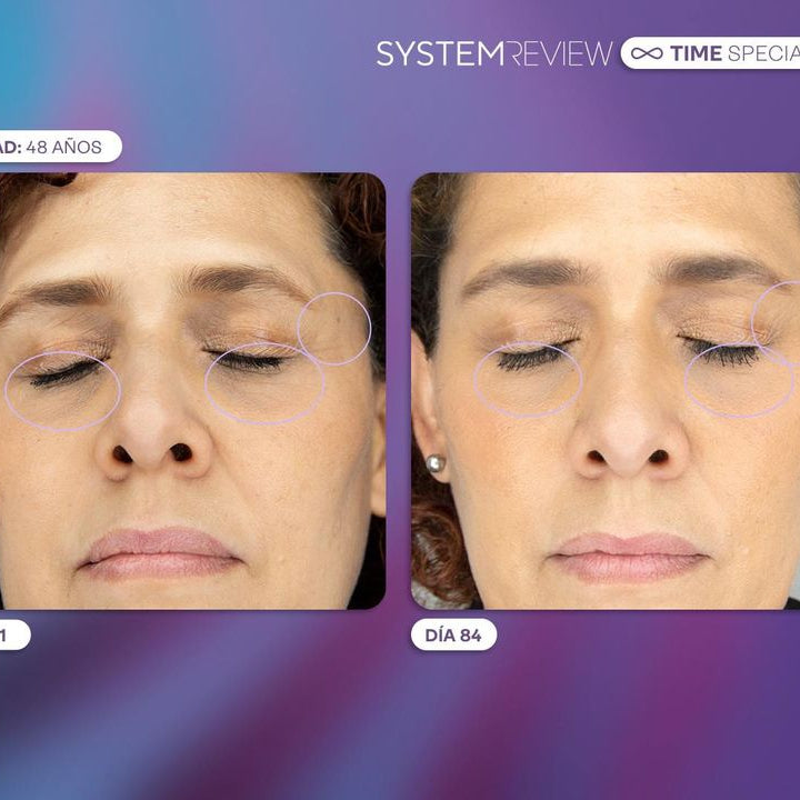 CREMA PARA CONTORNO DE OJOS